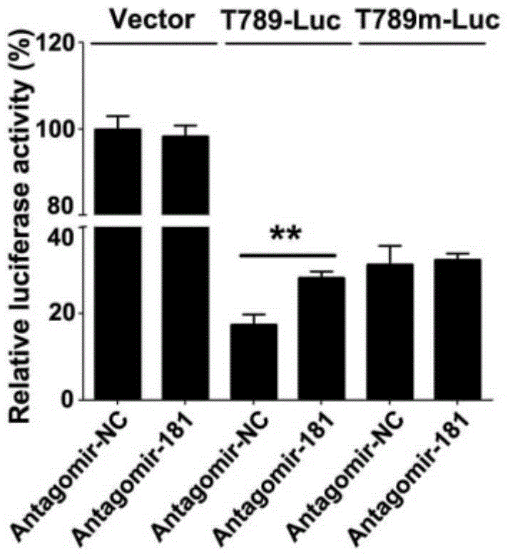 Application of miR181s in preparing drug for treating acute enteritis