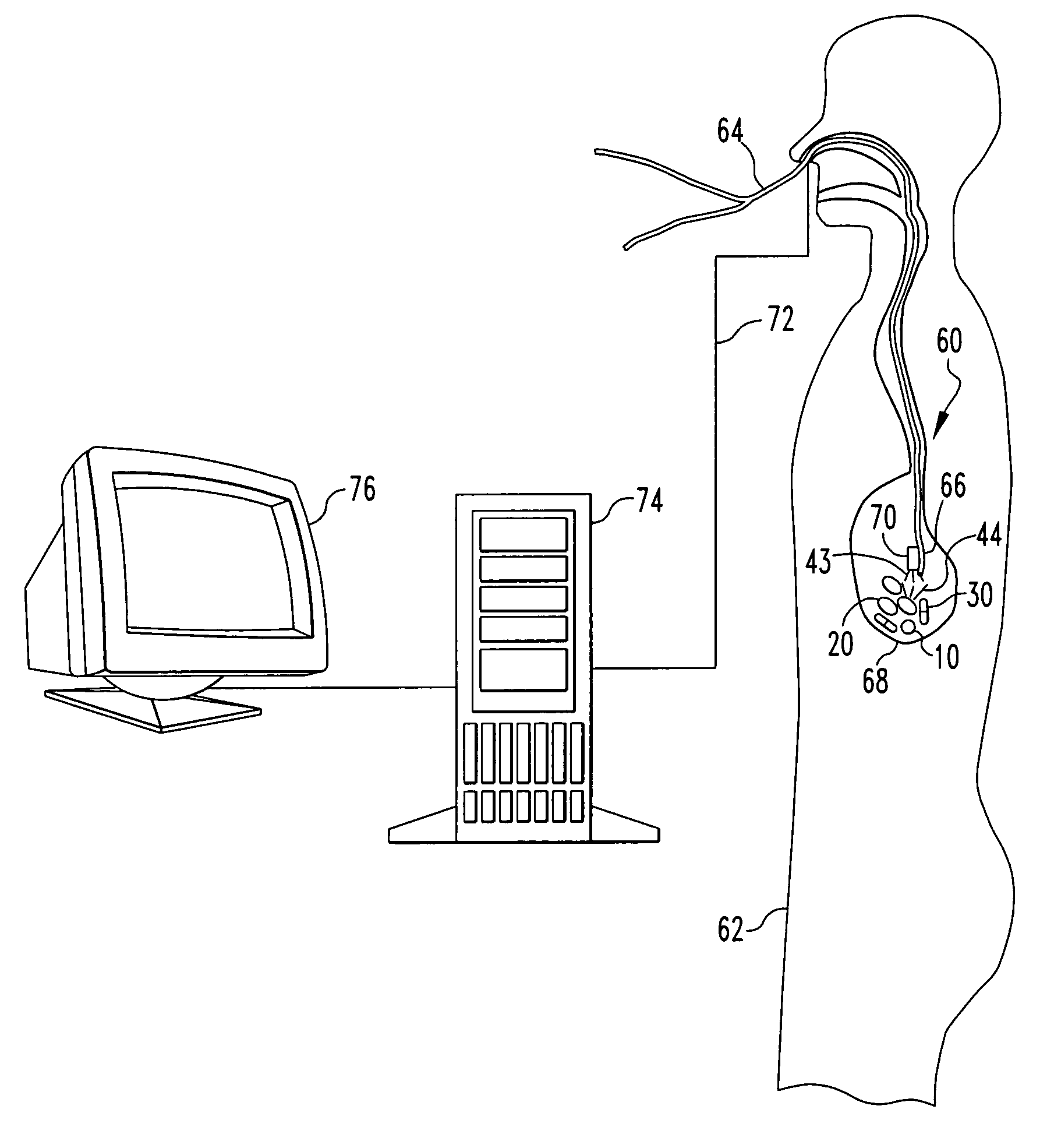 Radio frequency identification pharmaceutical tracking system and method