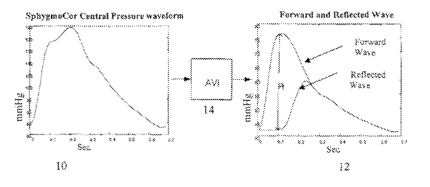 Method for determination of cardiac output