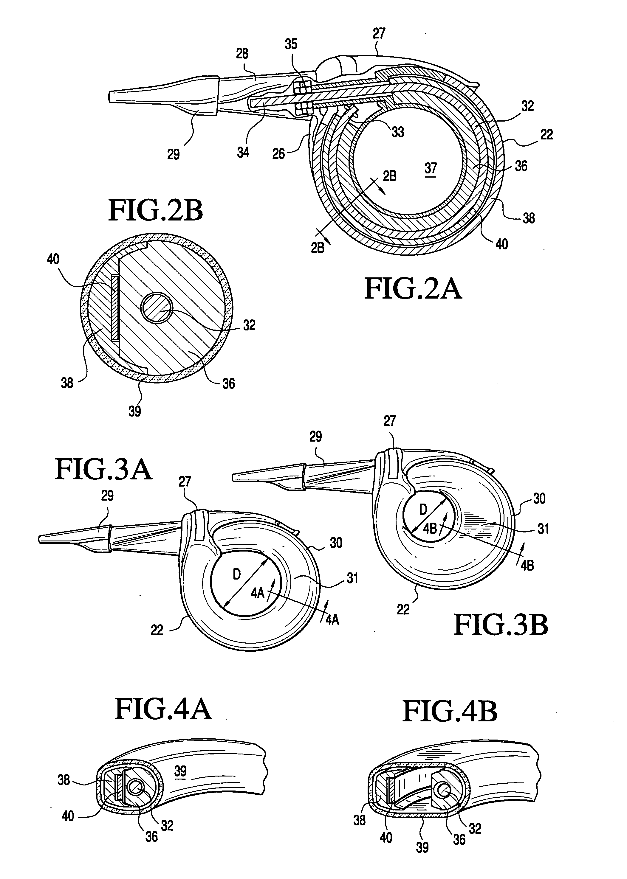 Telemetrically controlled band for regulating functioning of a body organ or duct, and methods of making, implantation and use