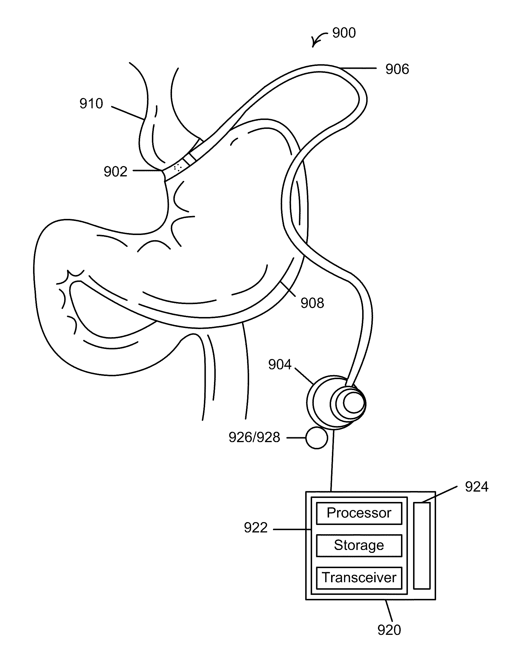 Feedback systems and methods to enhance obstructive and other obesity treatments