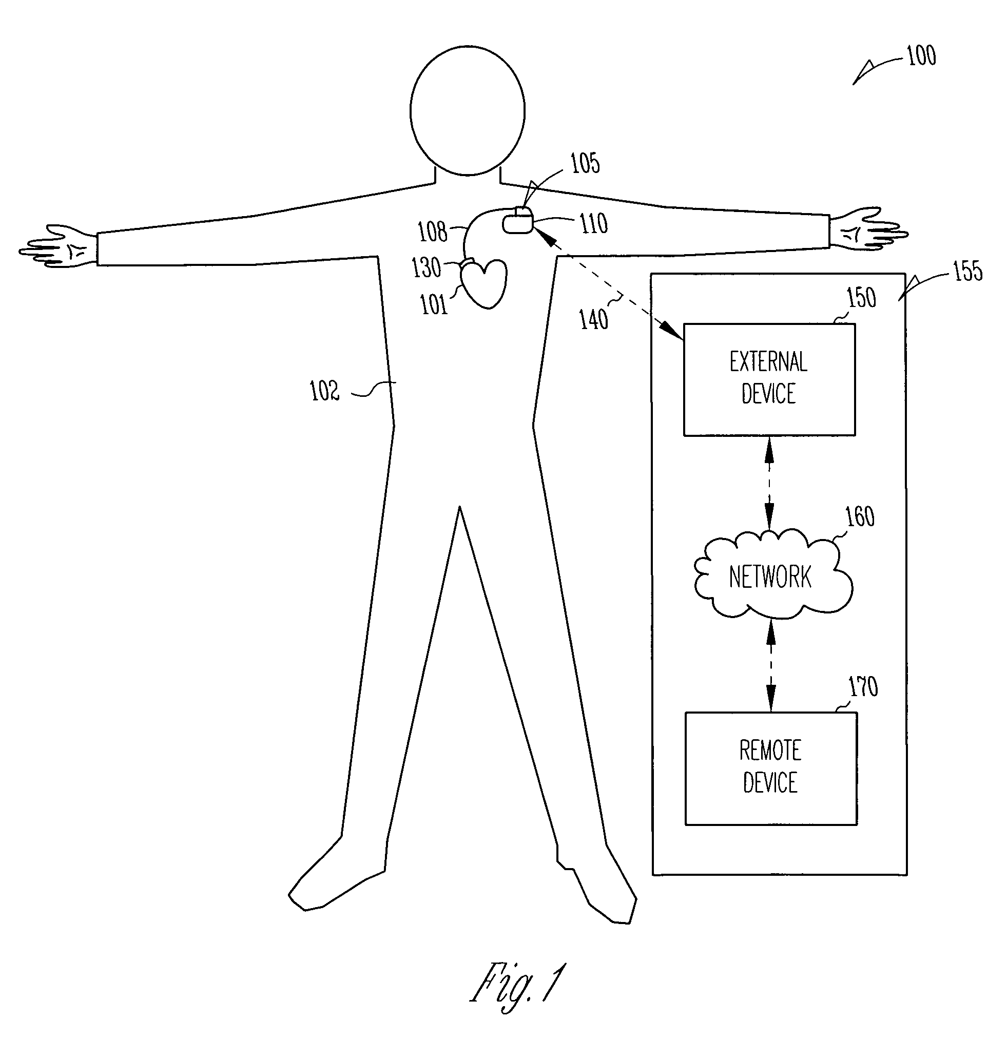 Method and apparatus for controlled gene or protein delivery