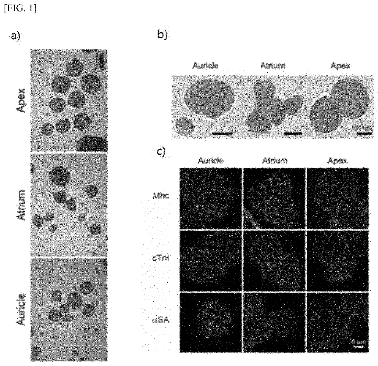 Preparation method of human-derived cardiac stem cell spheroid and use thereof