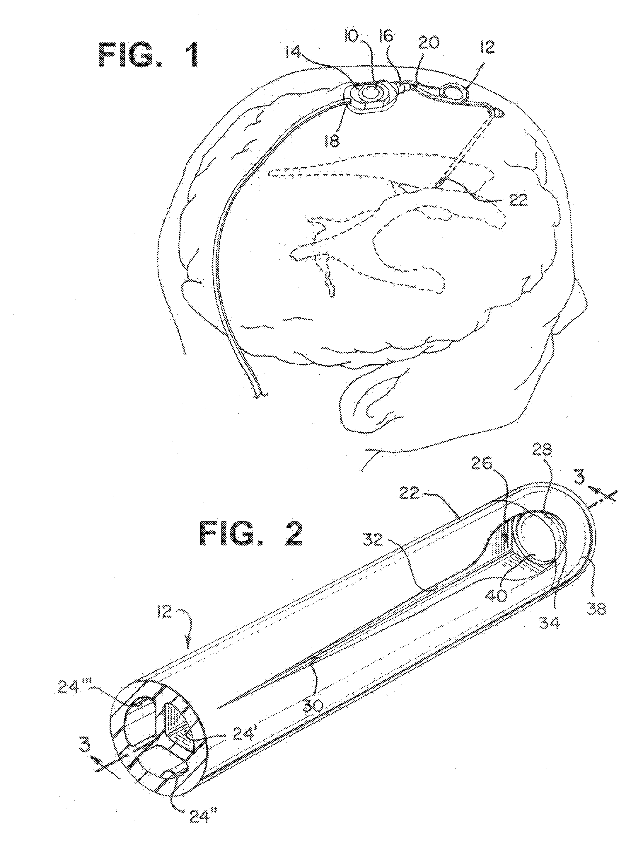 Multi-lumen ventricular drainage catheter