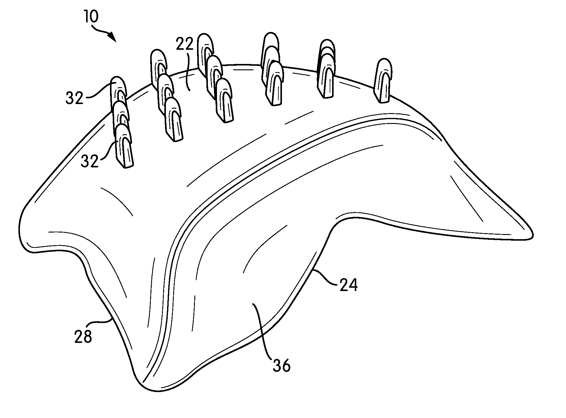 Malar Implant with Dual-Plane Adhesion