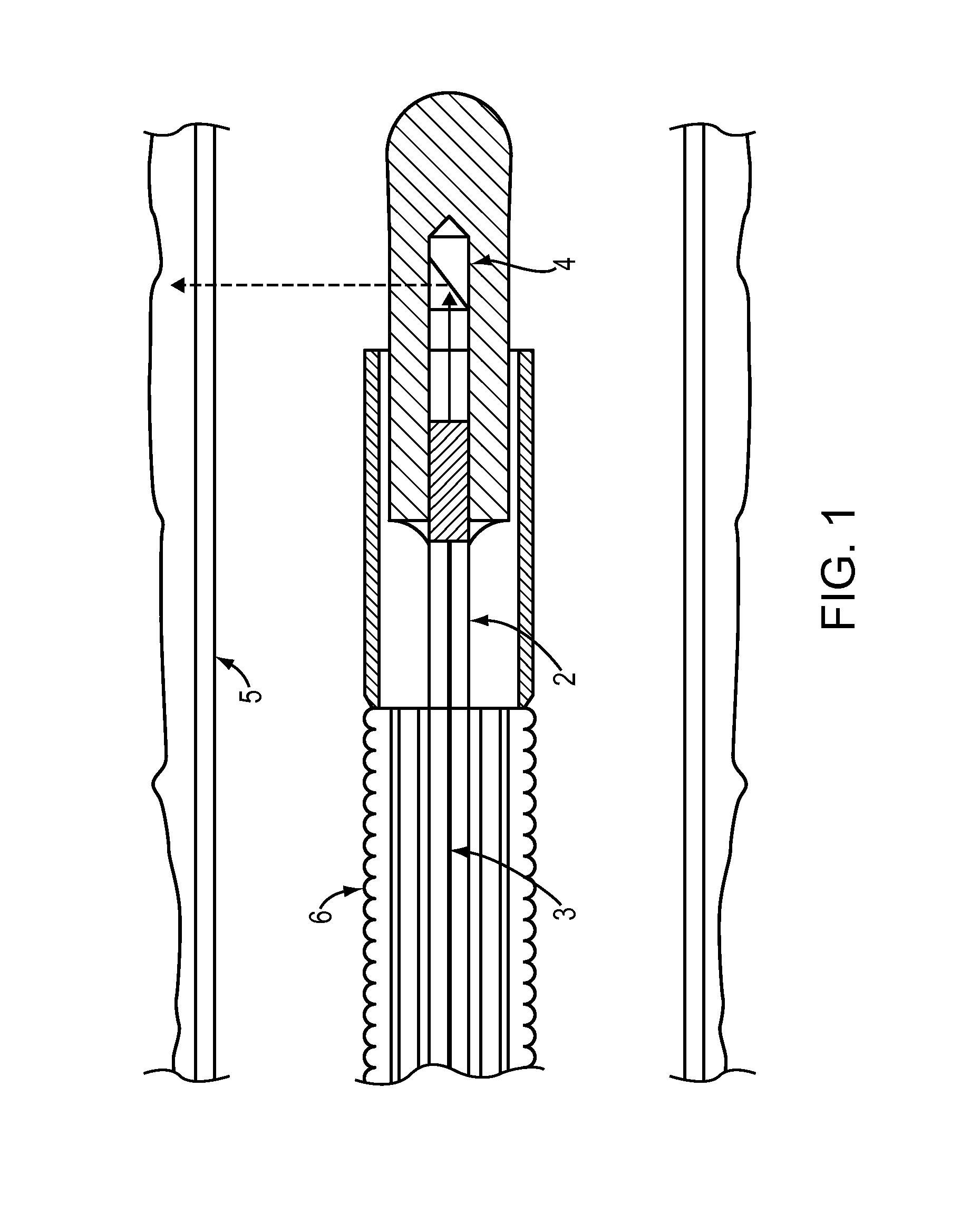 Optical coherence tomography and pressure based systems and methods