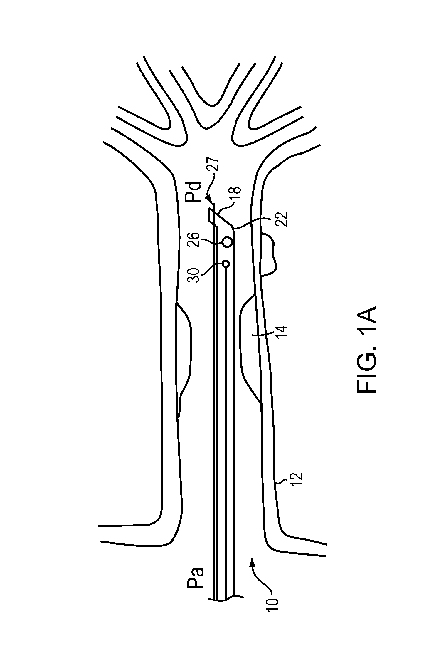 Optical coherence tomography and pressure based systems and methods