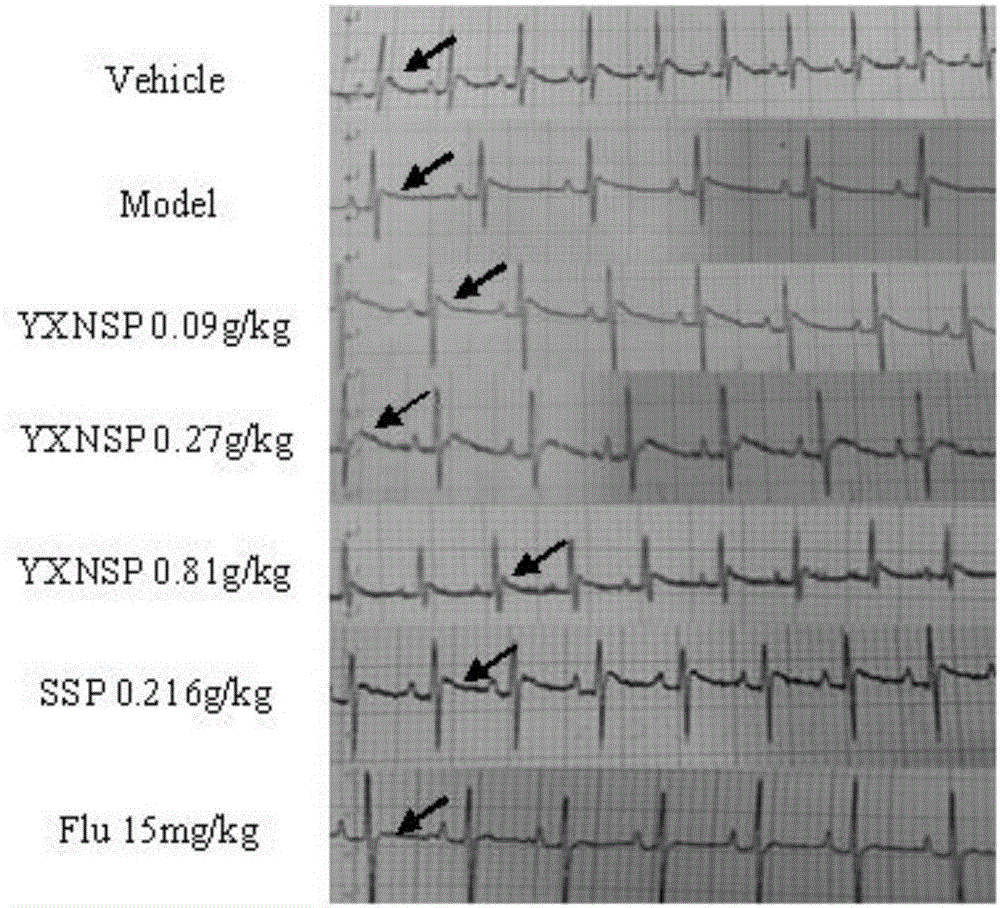 Application of heart-invigorating and calming tablet in preparation of medicine for curing heart diseases