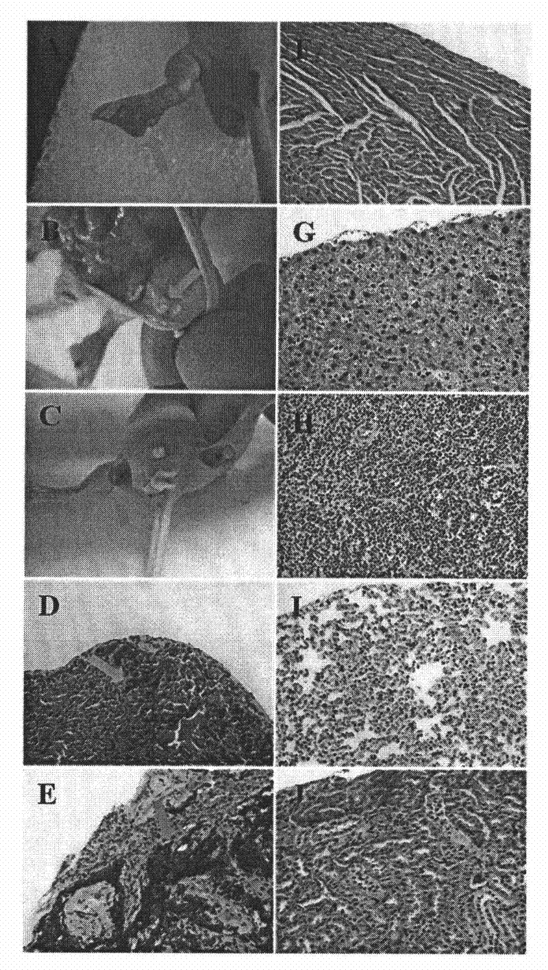 An active targeting liposome delivery system for tumors in situ and lymphatic metastases