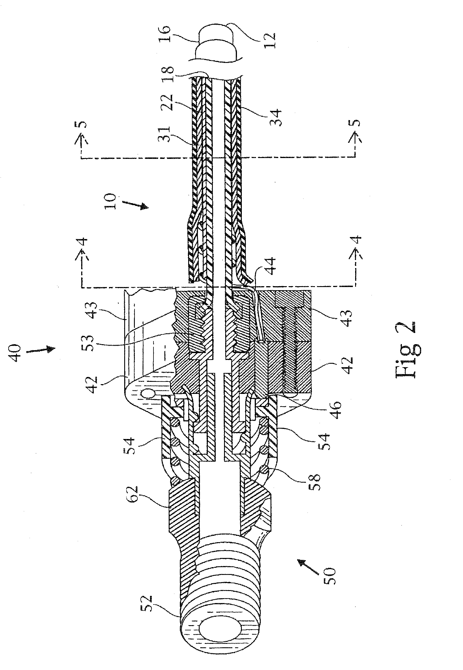 Tracheobronchial pulmonary cryogenic therapeutic method and apparatus