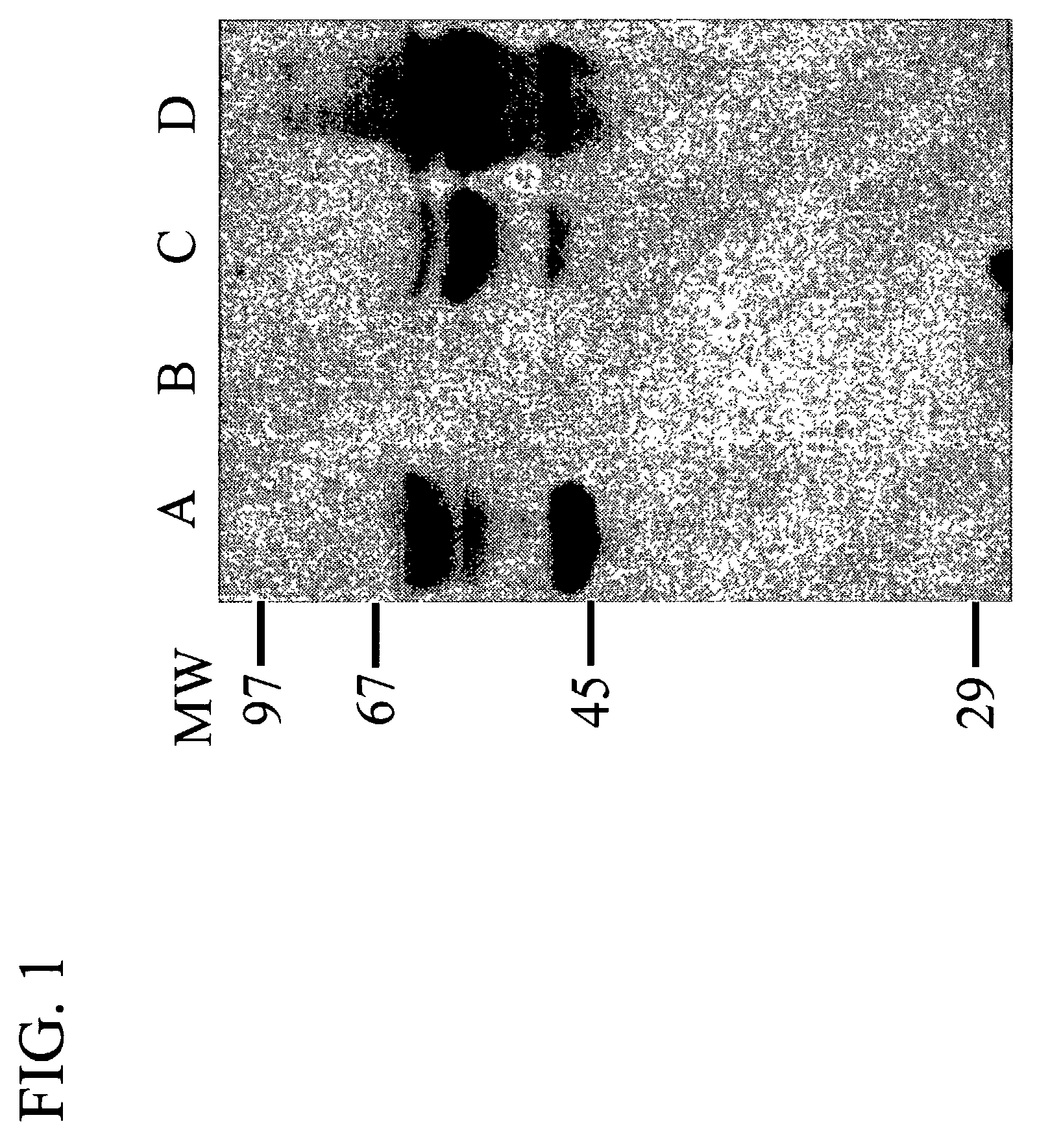 Methods and compositions for diagnosing breast cancer