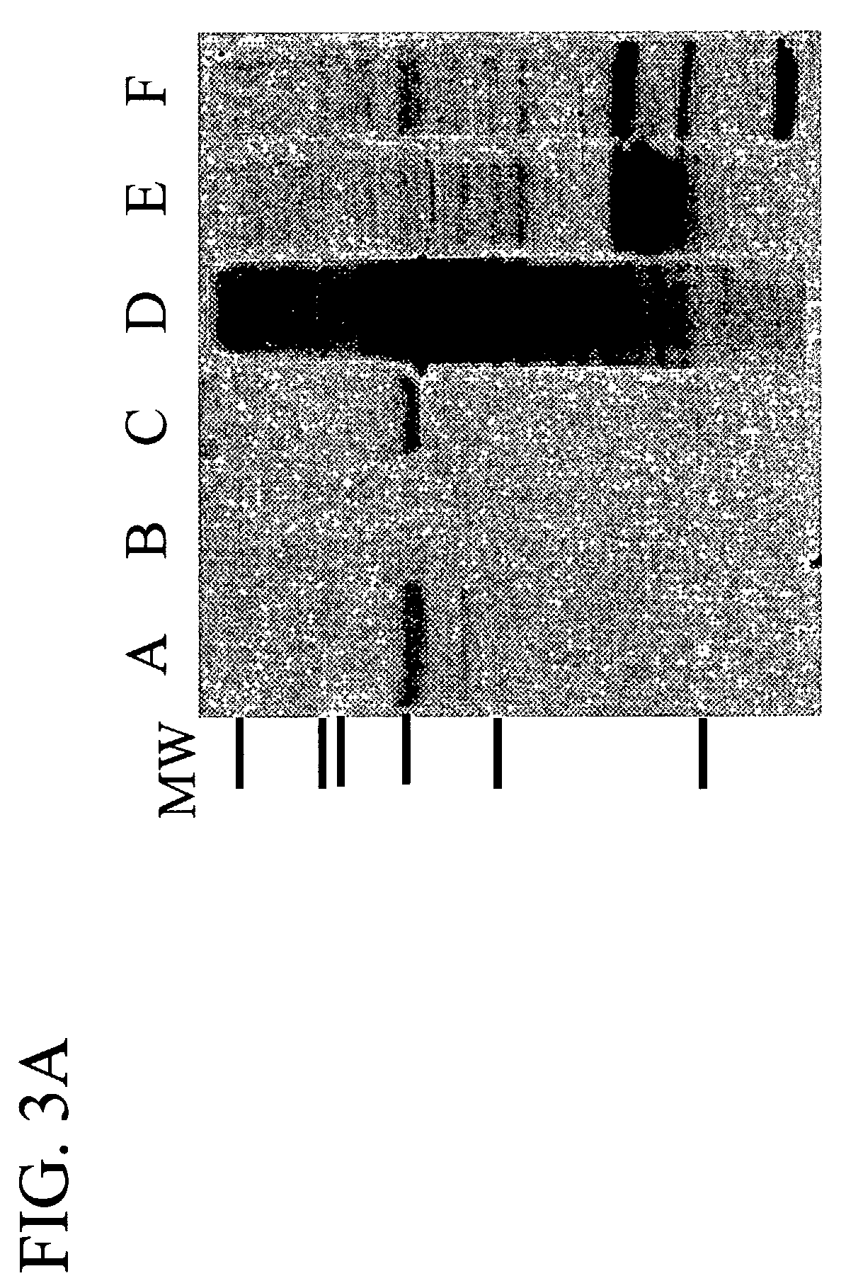 Methods and compositions for diagnosing breast cancer