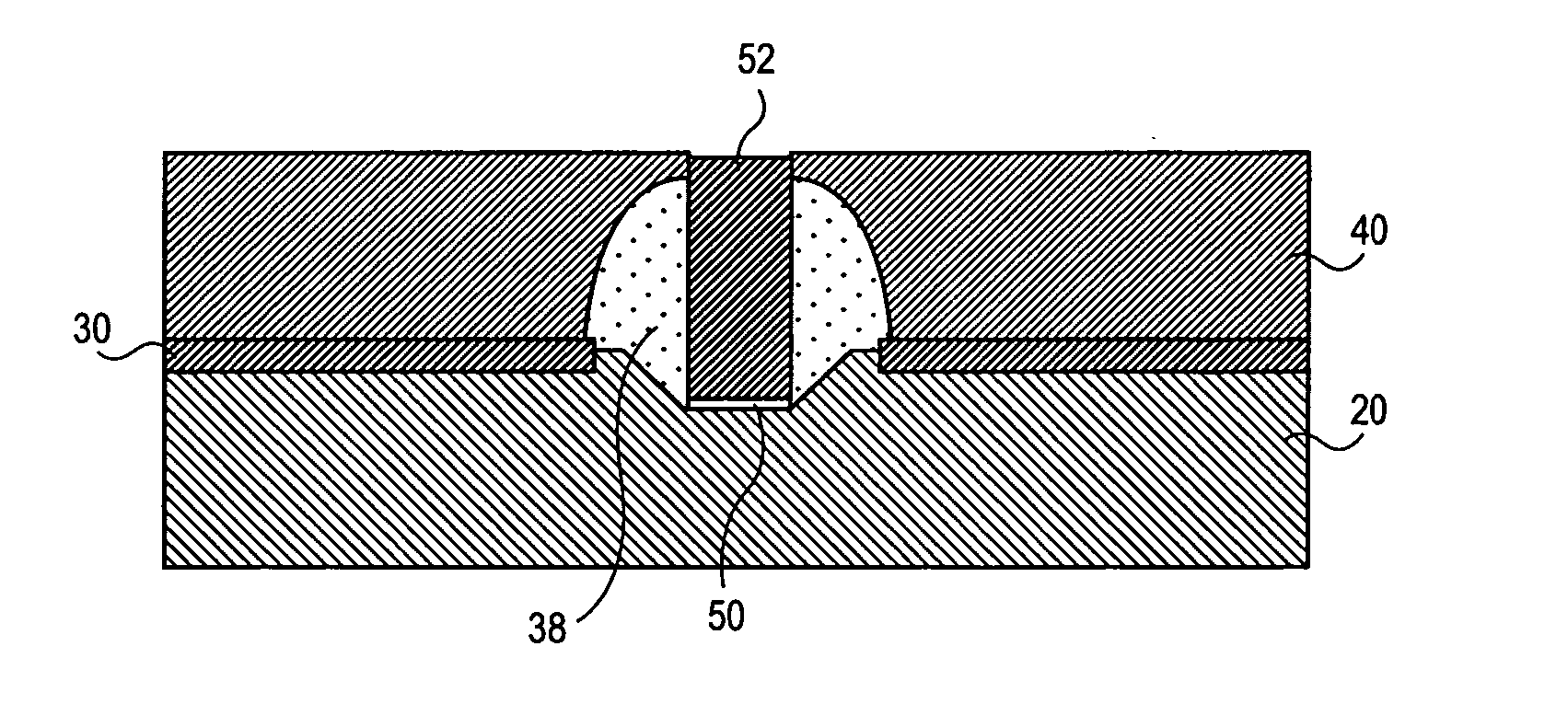 Method and structure for reducing the external resistance of a three-dimensional transistor through use of epitaxial layers