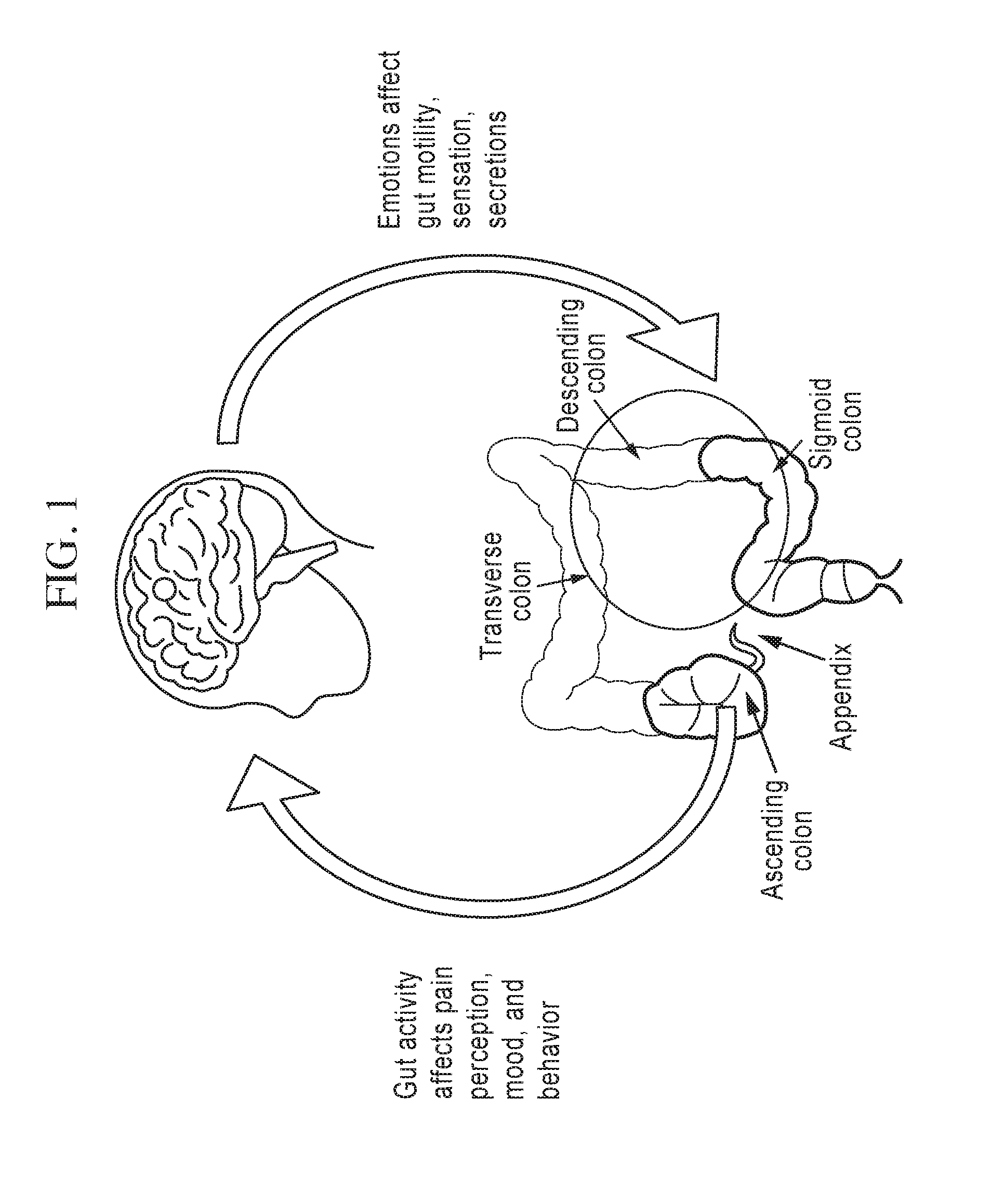 Therapeutic undergarments for the treatment of functional gastrointestinal disorders including irritable bowel syndrome