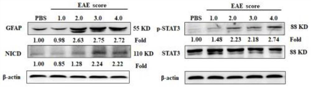 LncRNA targeting Notch1 gene and use of LncRNA