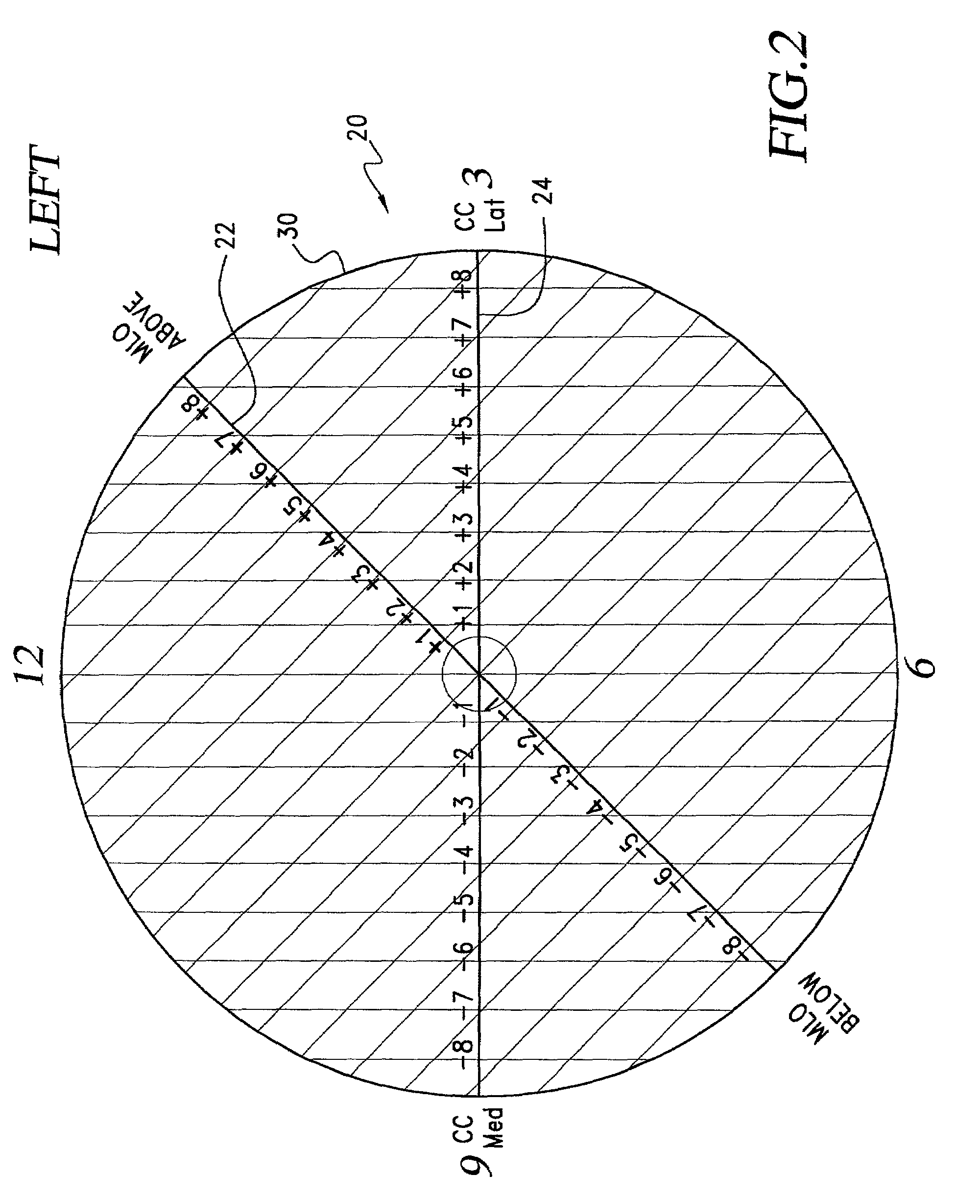 Template for the localization of lesions in a breast and method of use thereof