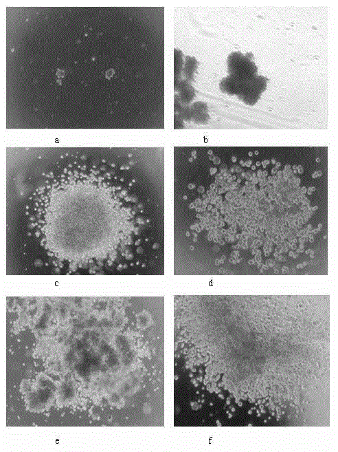 Monocyte culture solution