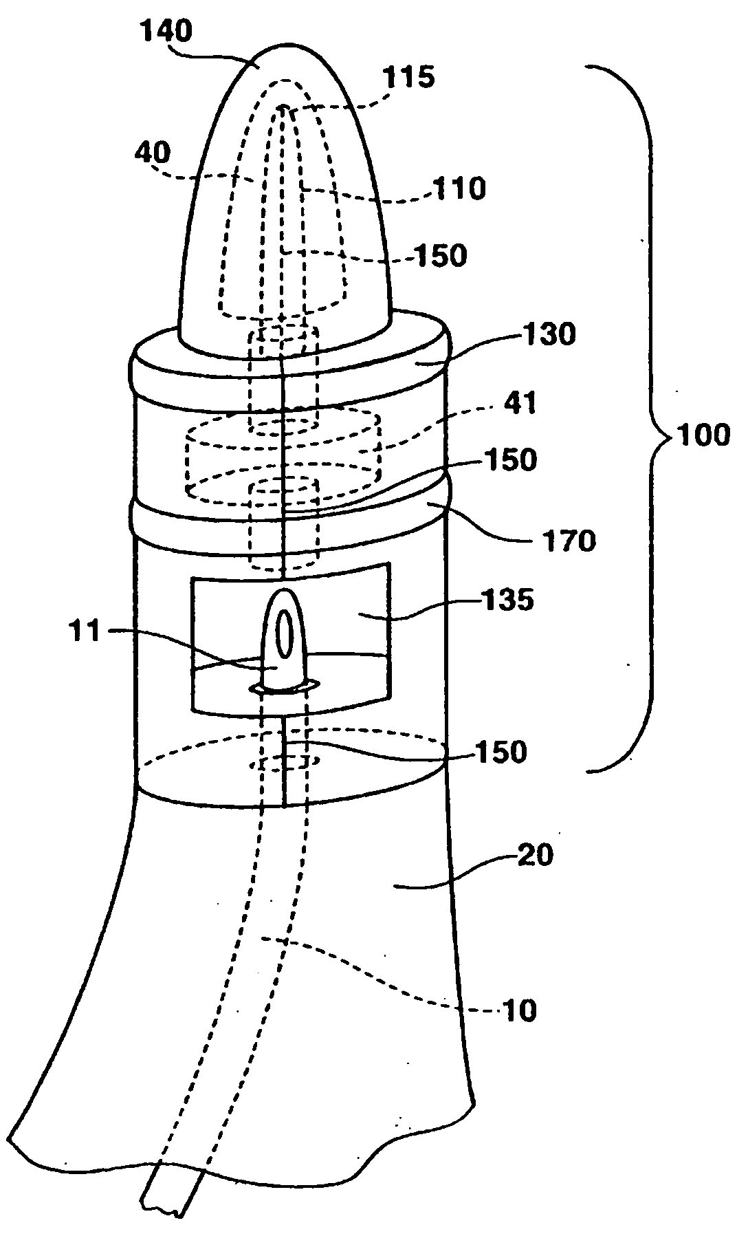 Catheter application system