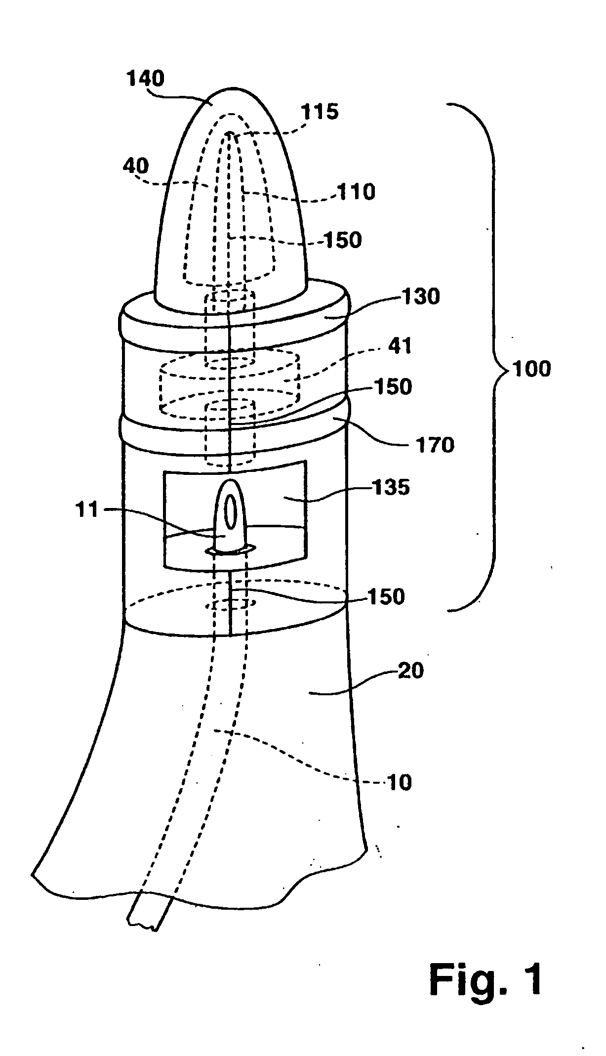 Catheter application system