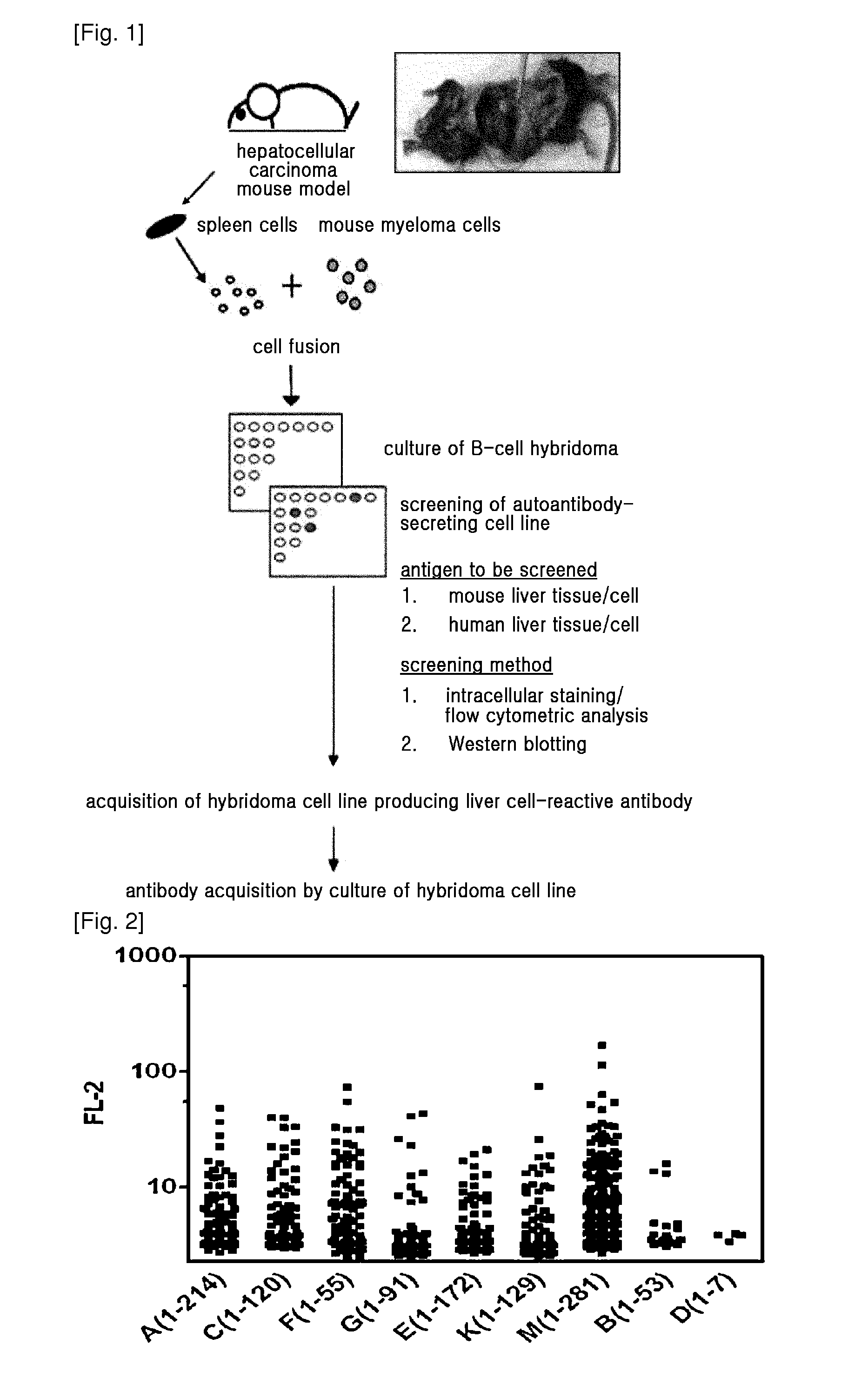 Diagnostic Marker for Hepatocellular Carcinoma Comprising Anti-FASN Autoantibodies and a Diagnostic Composition for Hepatocellular Carcinoma Comprising Antigens Thereof