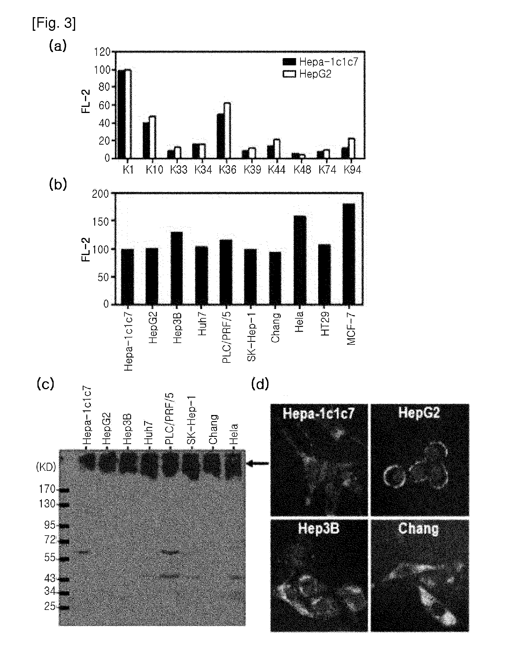 Diagnostic Marker for Hepatocellular Carcinoma Comprising Anti-FASN Autoantibodies and a Diagnostic Composition for Hepatocellular Carcinoma Comprising Antigens Thereof