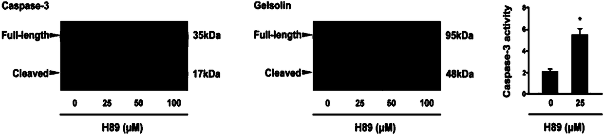 Use of protein kinase A inhibitor in preparation of medicament for treating diseases related to increase of number of platelets