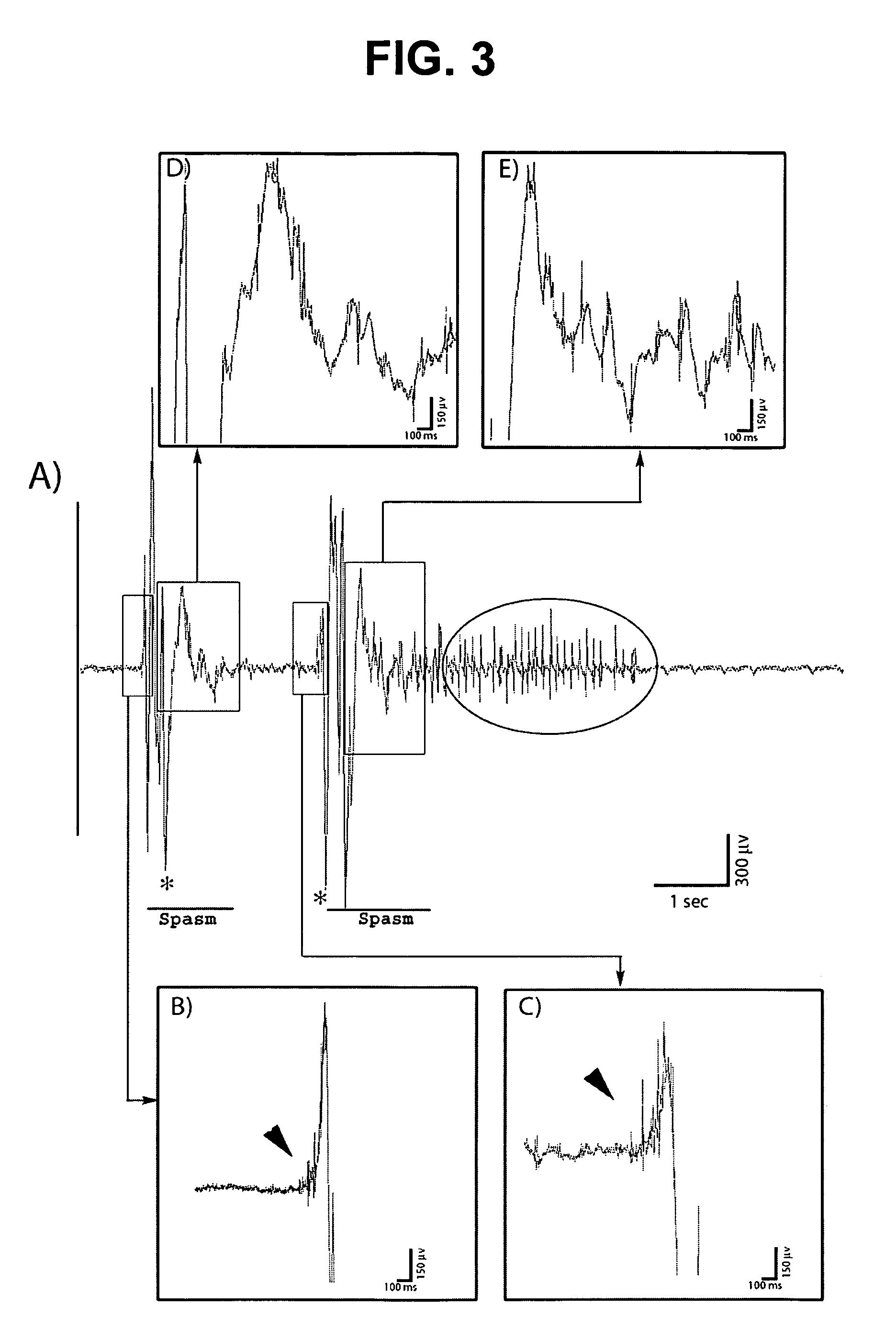 Model of infantile spasm syndrome