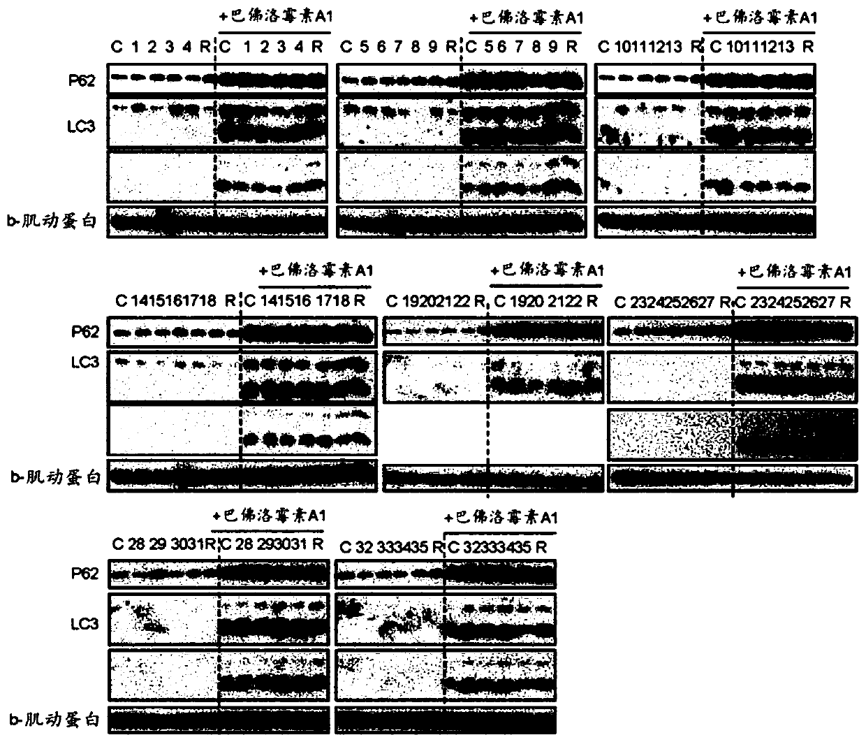 Autophagy improving material and use thereof