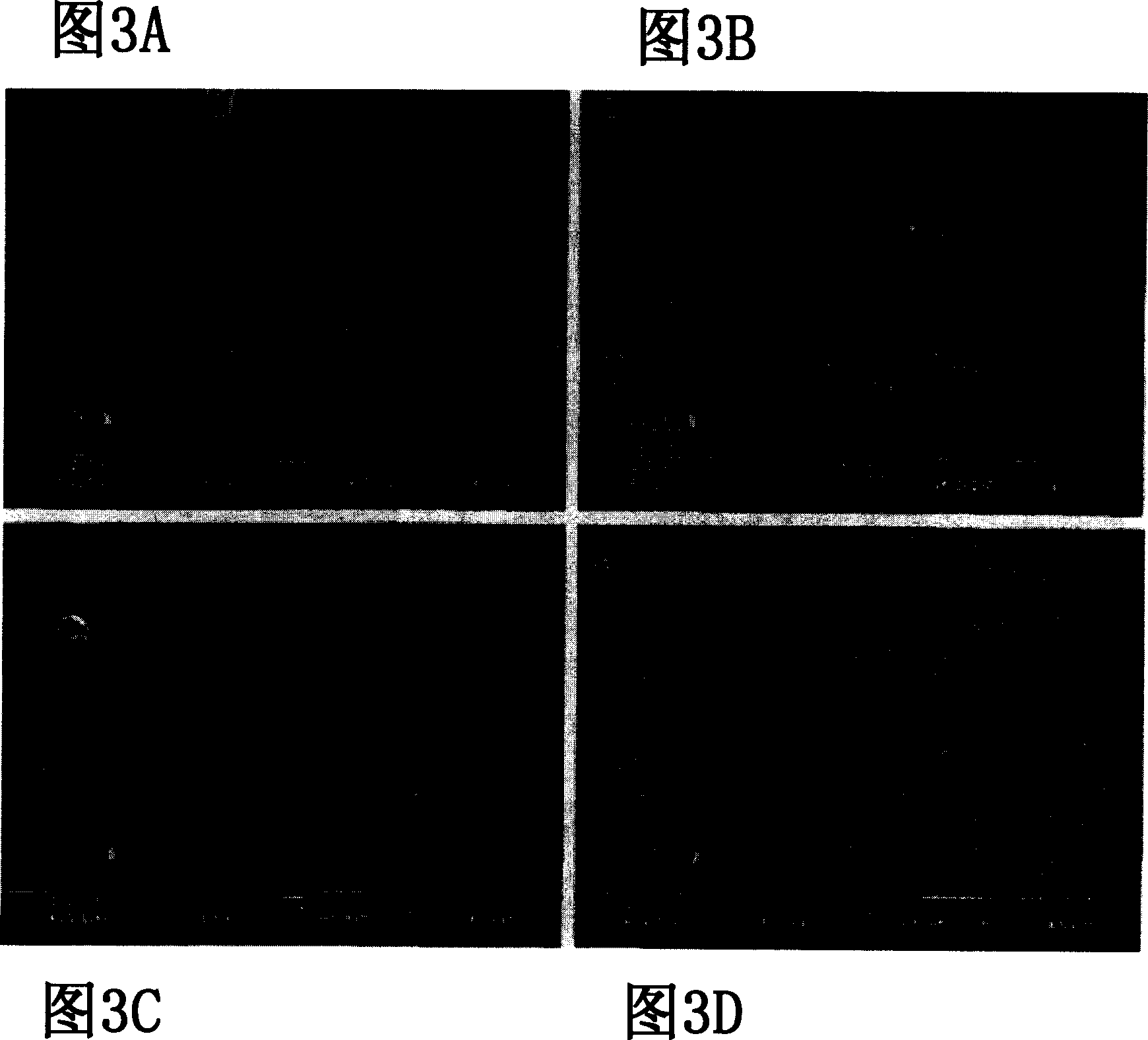 Lysozyme-chitosan films