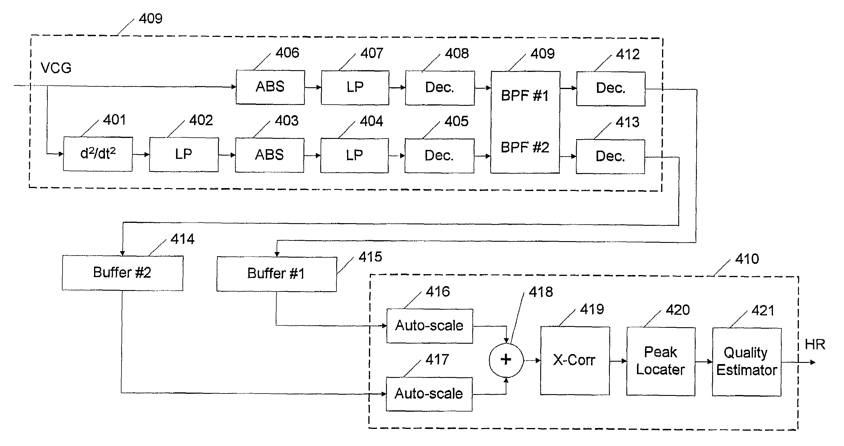 Method and an apparatus for processing auscultation signals