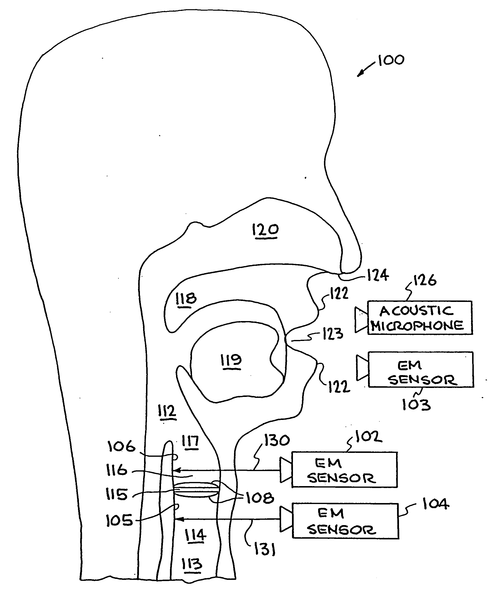 System and method for characterizing voiced excitations of speech and acoustic signals, removing acoustic noise from speech, and synthesizing speech