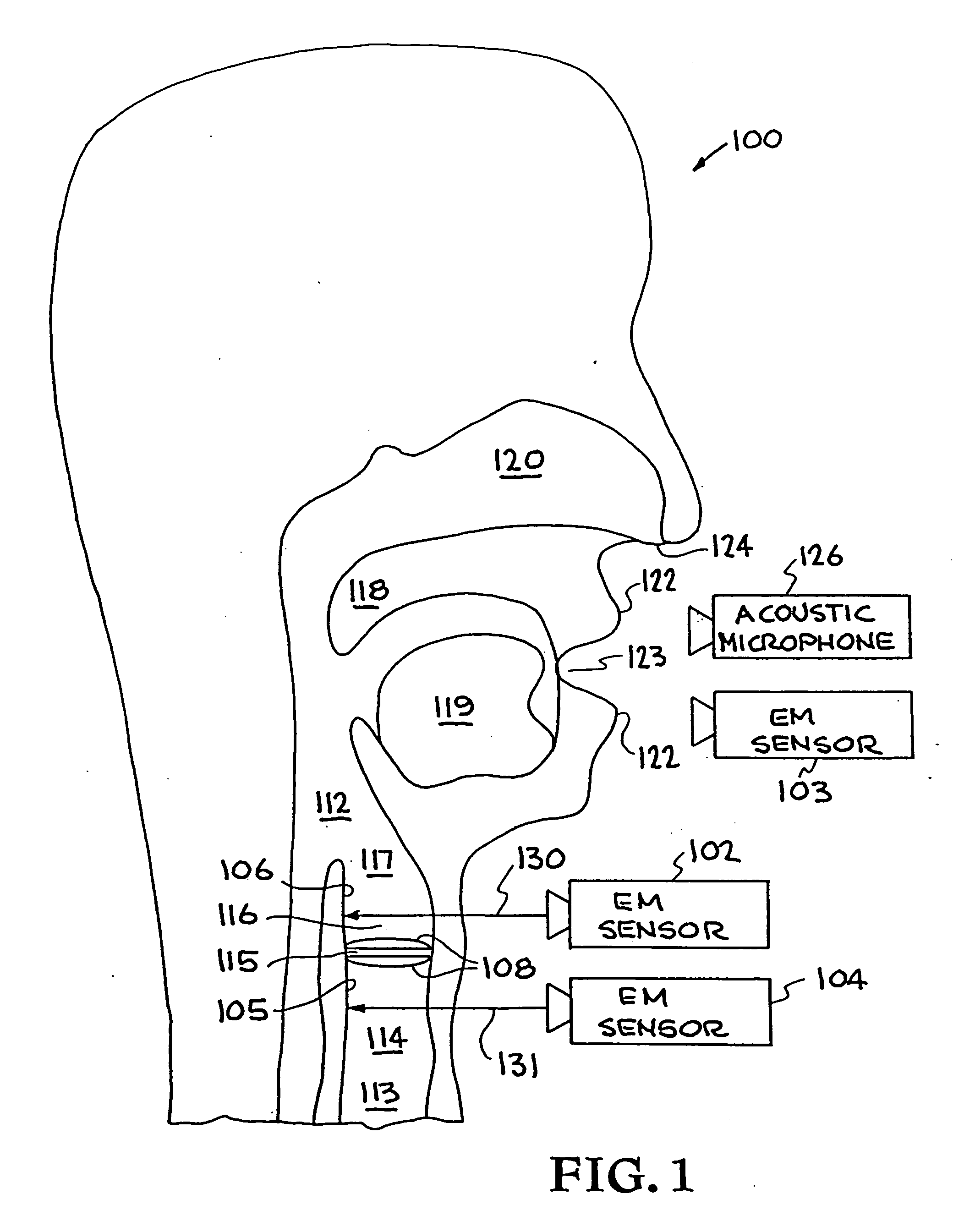 System and method for characterizing voiced excitations of speech and acoustic signals, removing acoustic noise from speech, and synthesizing speech