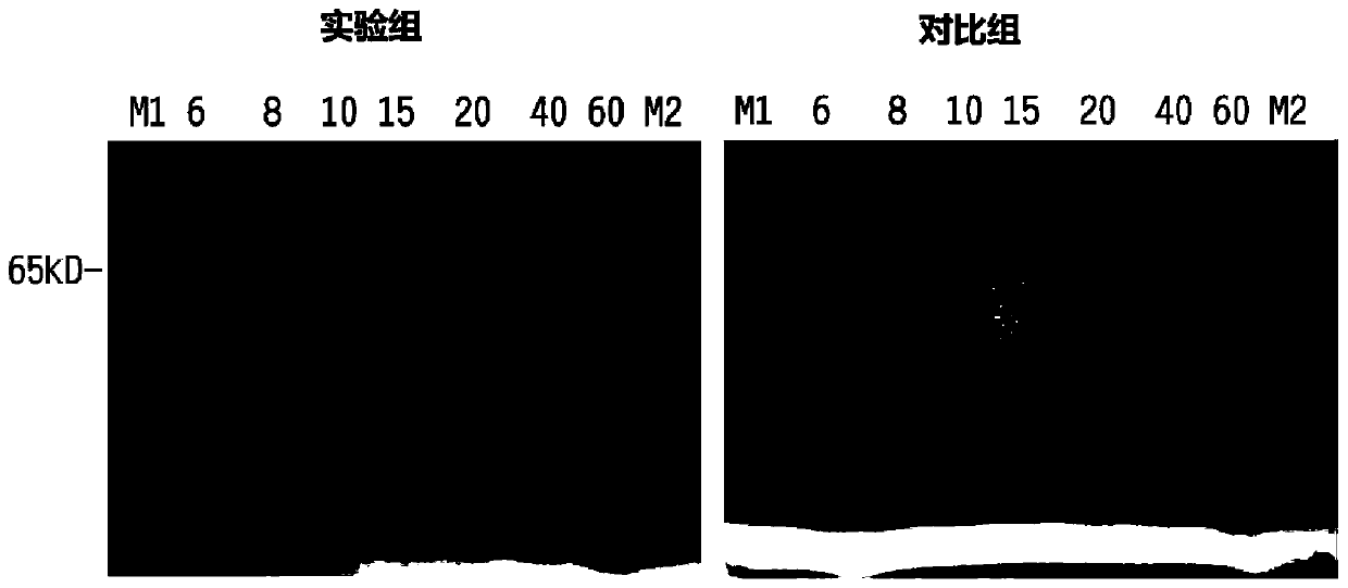 A rapid Coomassie brilliant blue staining solution