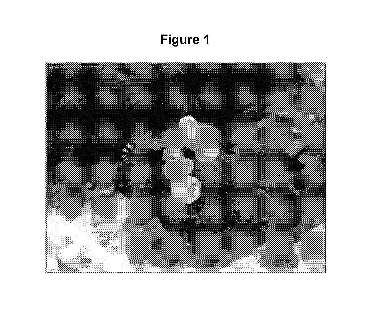 Production of plants using somatic embryogenesis