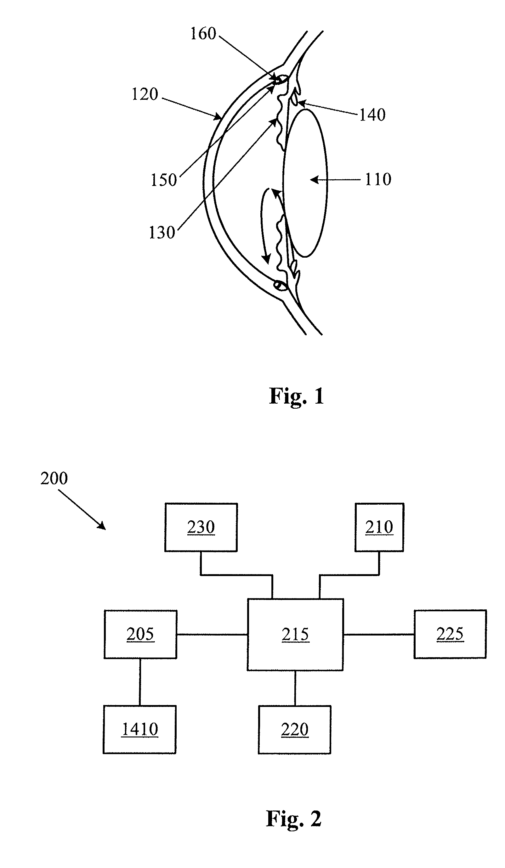 Glaucoma drainage device with pump