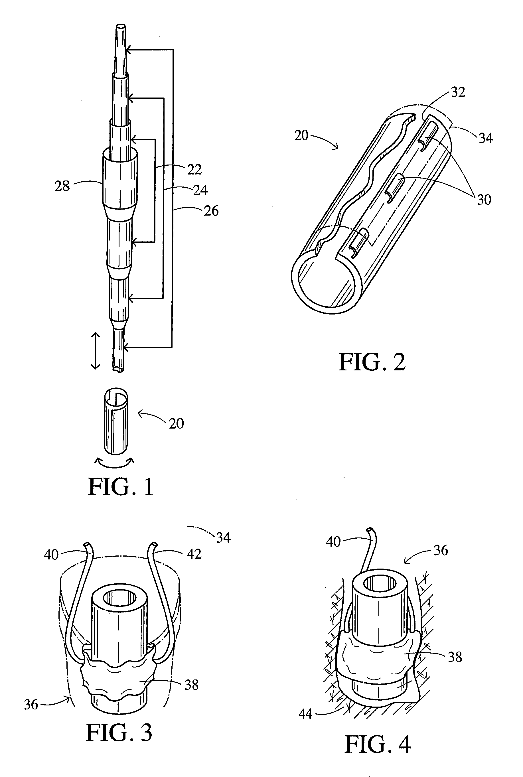 Method for minimally invasive surgery using therapeutic ultrasound to treat spine and orthopedic diseases, injuries and deformities