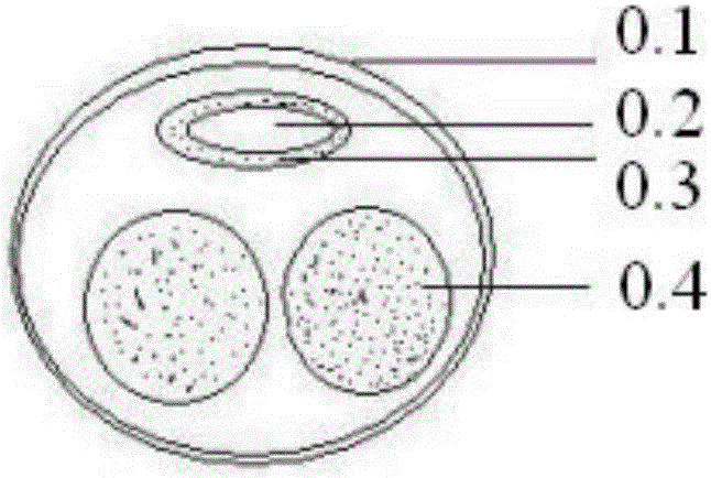 Novel urethral clamp for treating male urinary incontinence