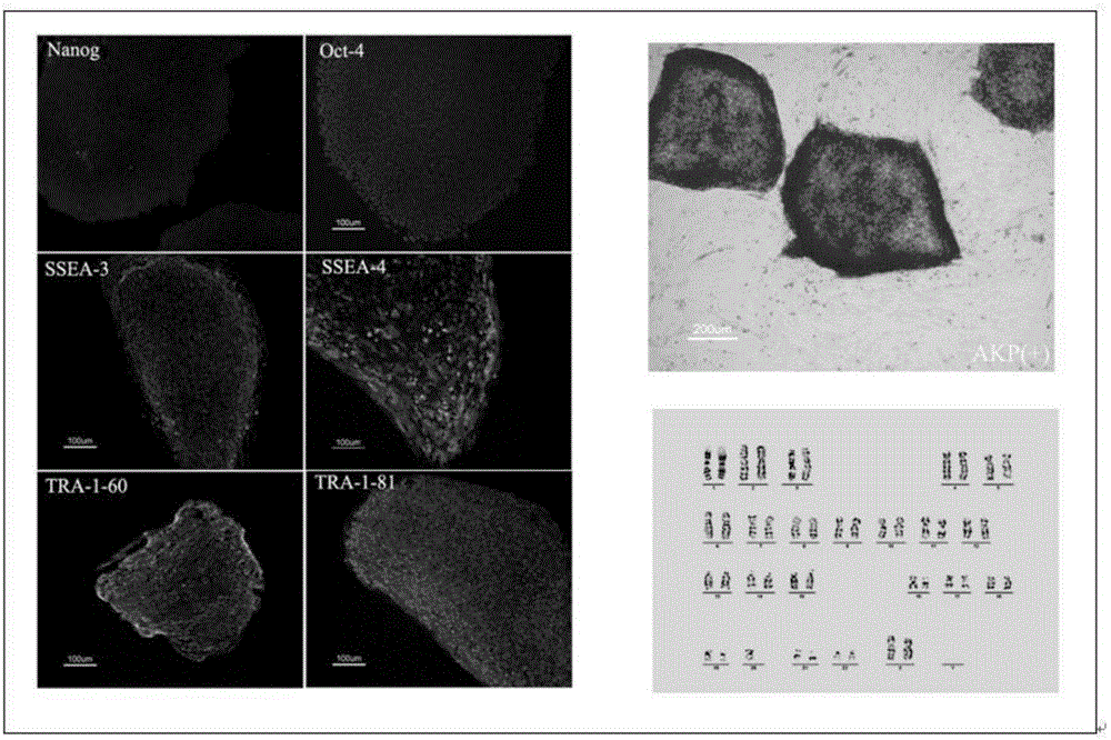 Method for establishing source of heredofamilial premature ovarian failure and inducing differentiation of totipotential stem cells to original genital ridge cells