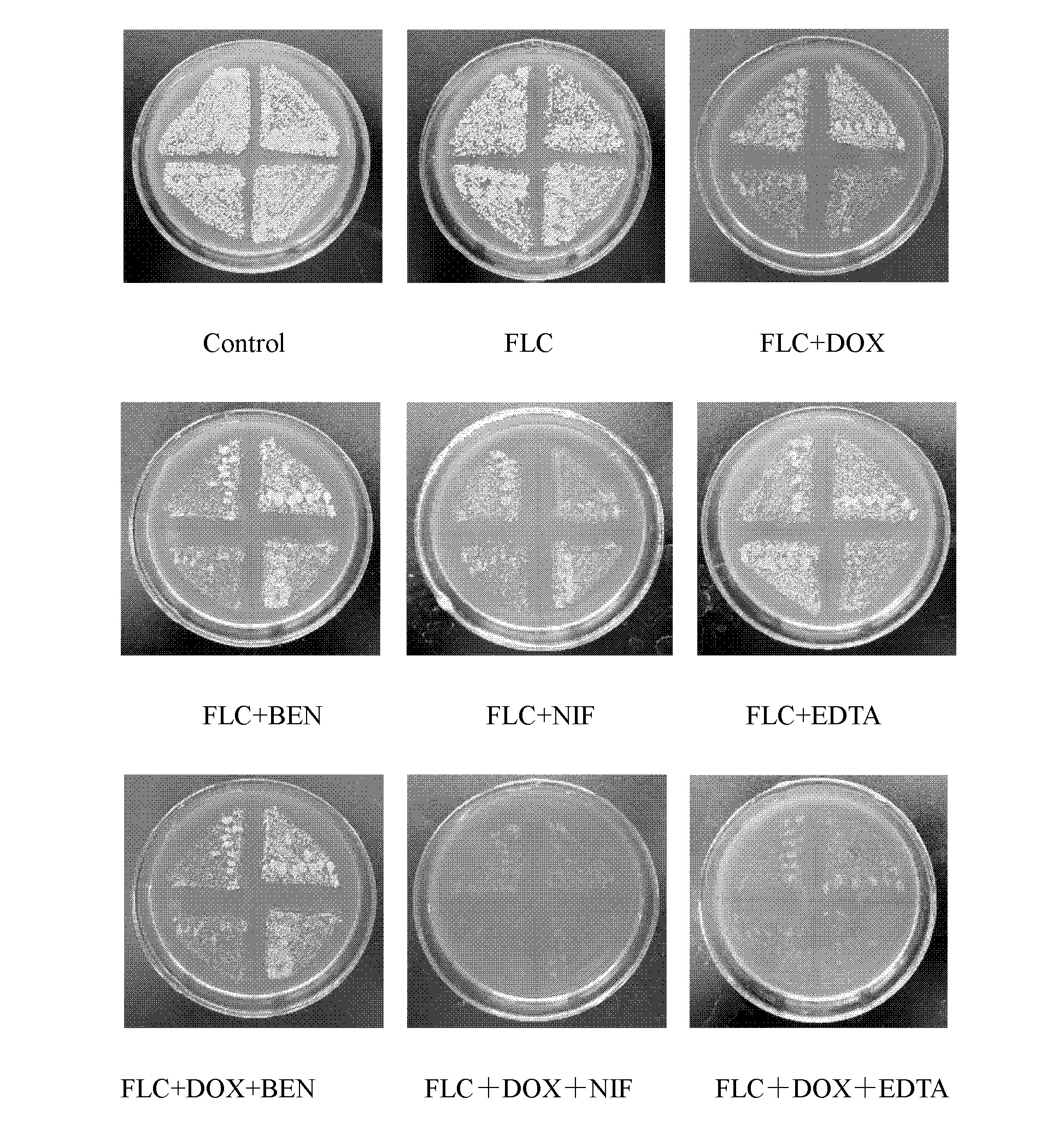 Application of combination of tetracycline medicine and fluconazole in preparation of antifungal product, and product thereof