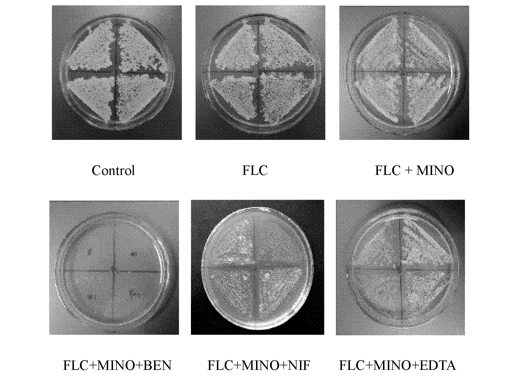 Application of combination of tetracycline medicine and fluconazole in preparation of antifungal product, and product thereof