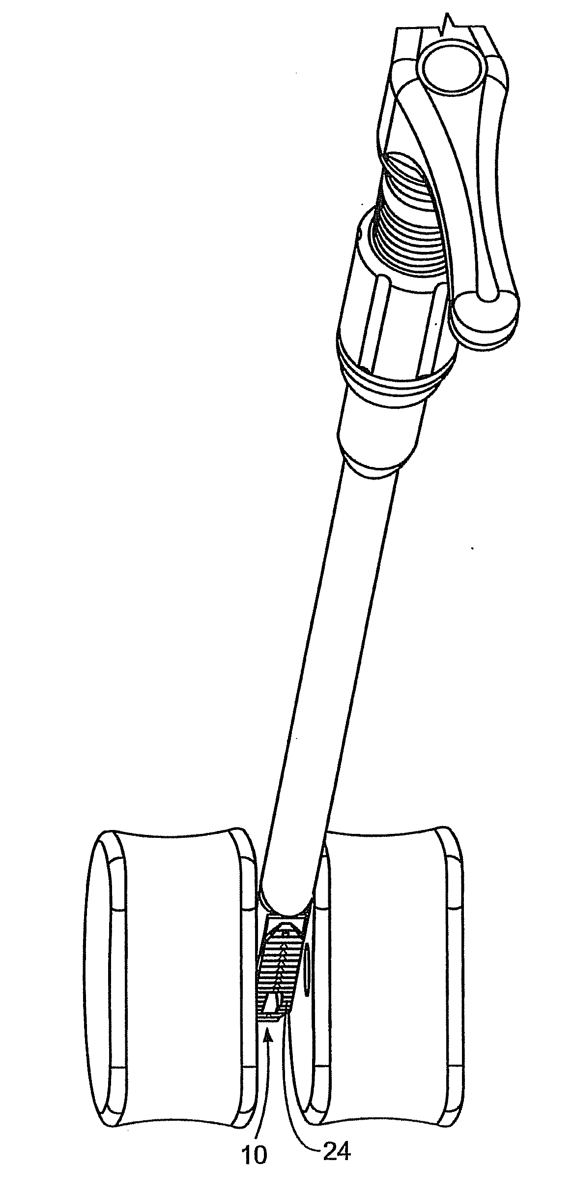 Methods and Systems for Interbody Implant and Bone Graft Delivery