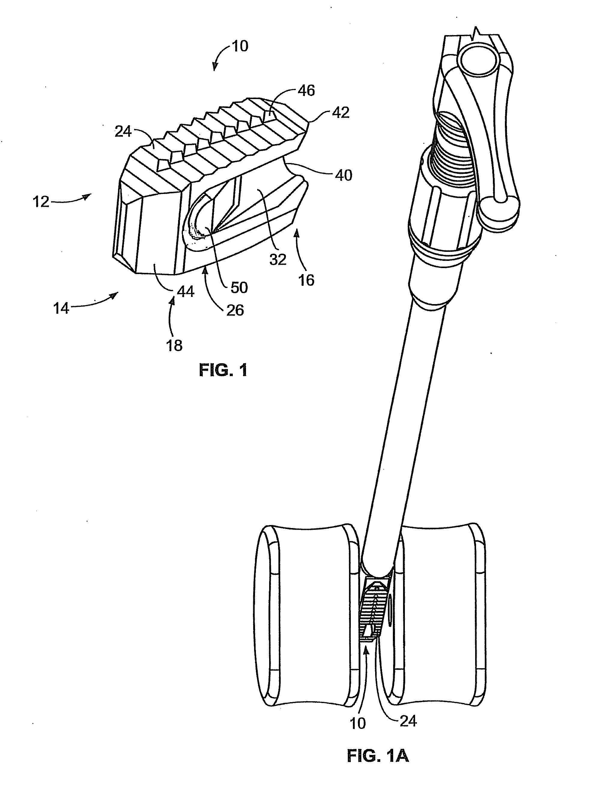 Methods and Systems for Interbody Implant and Bone Graft Delivery