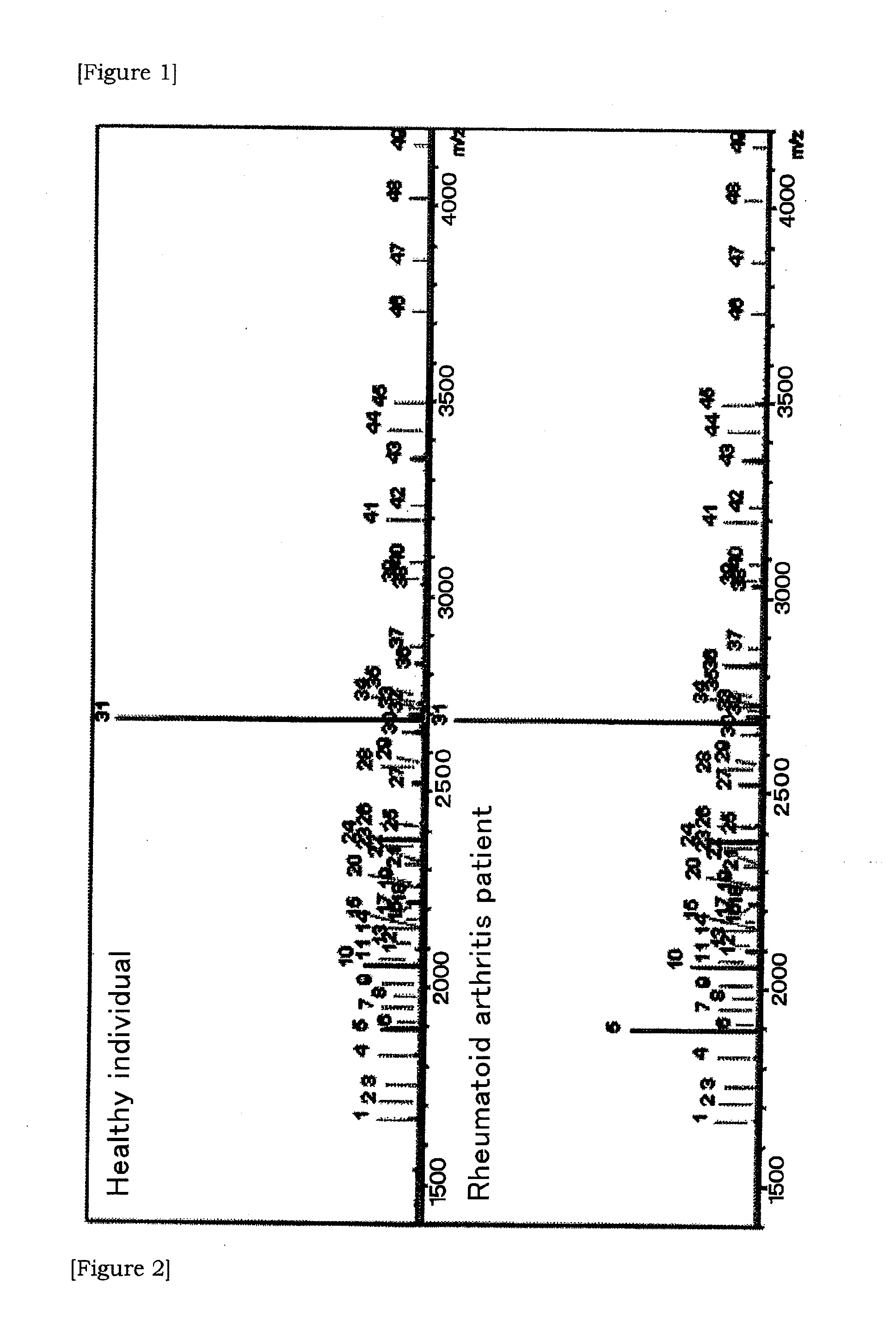 Method of diagnostic rheumatoid arthritis by sugar chain analysis