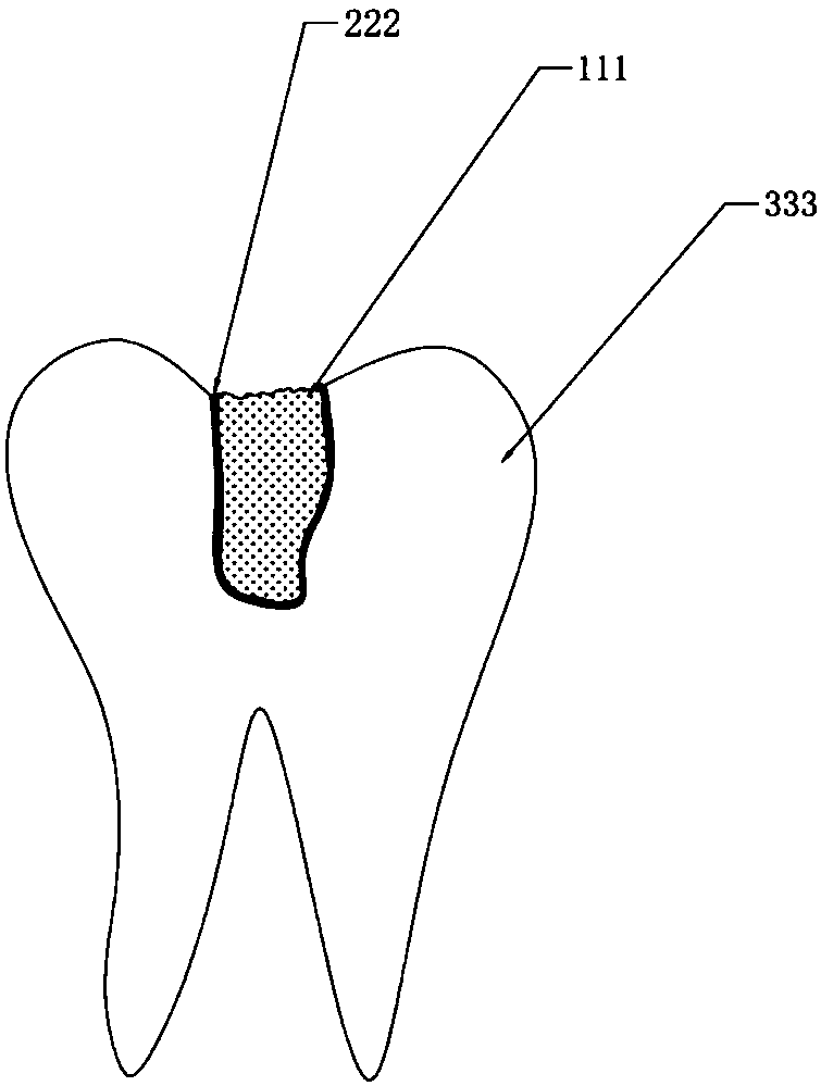 Liquid metal alloy tooth-filling material and preparation method thereof and injection molding machine