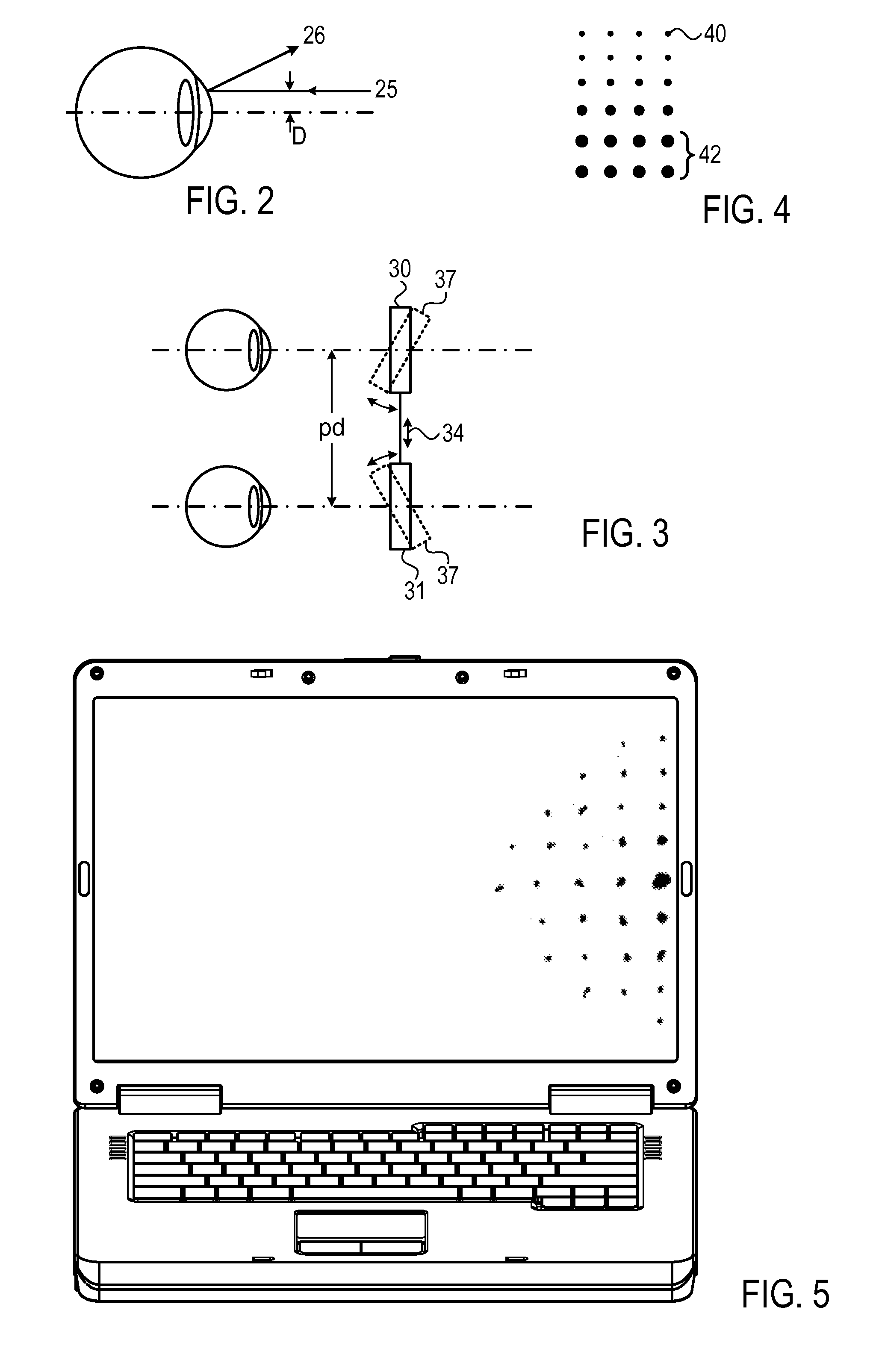 Objective phoropter system