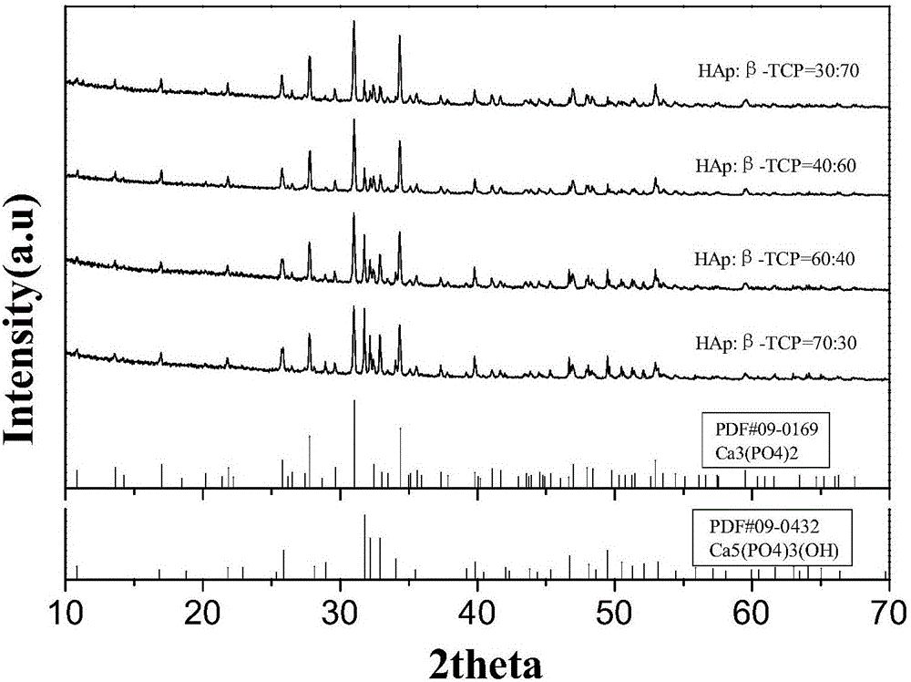 Biphase calcium phosphate (BCP) composite powder synthesized by high-temperature solid phase reaction and preparation method thereof