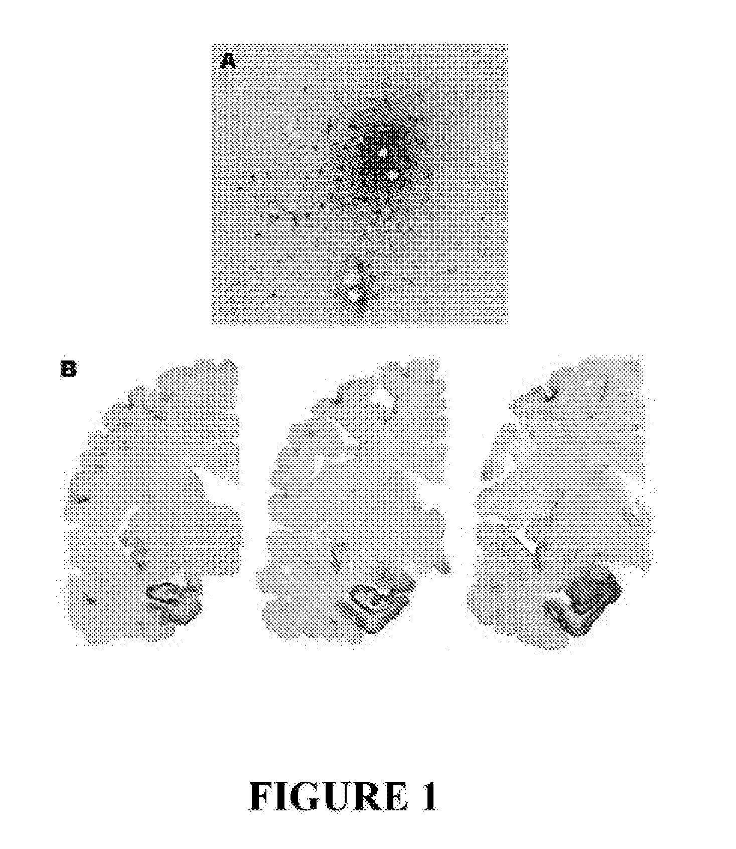 Method for Preventing and/or Treating Chronic Traumatic Encephalopathy - III