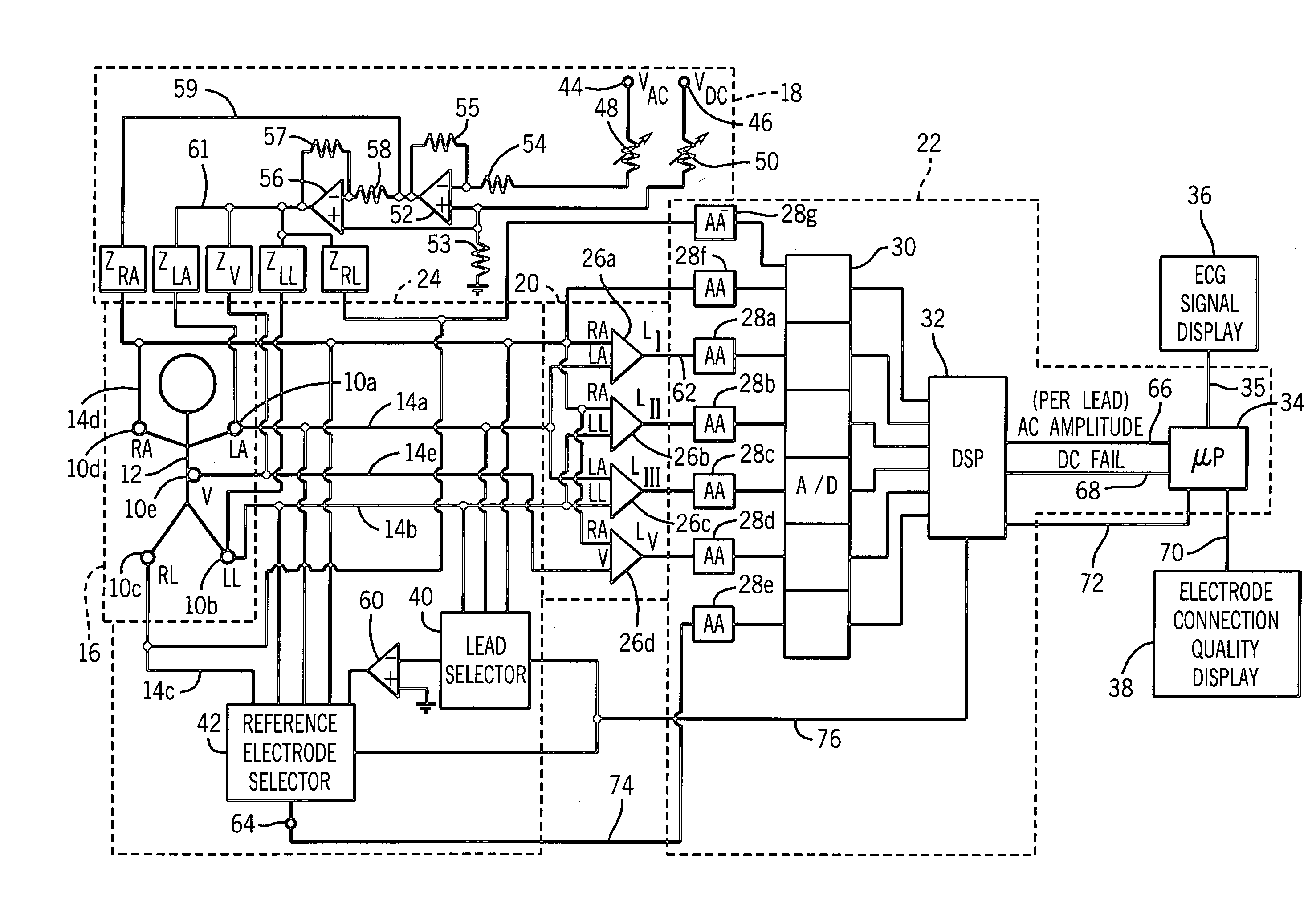 Impedance measurement apparatus for assessment of biomedical electrode interface quality