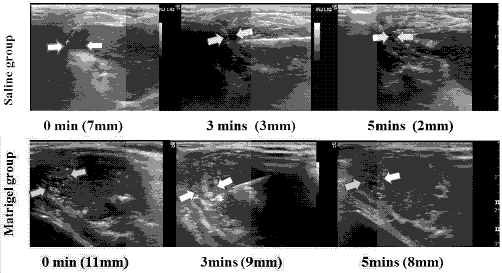 Application of thermosensitive material in preparation of injection for protecting organ peripheral structure in thermal ablation