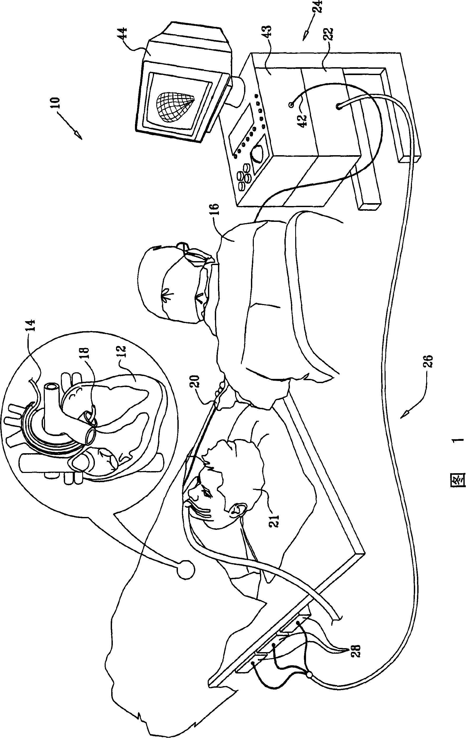 Mapping of complex fractionated atrial electrogram